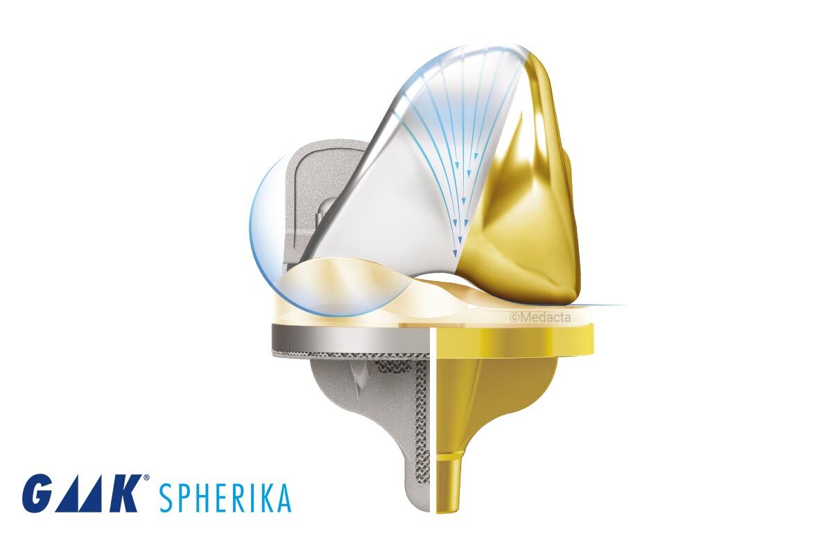 SpheriKA